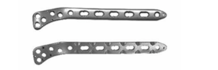 Латеральна підтримуюча блокуюча пластина для великогомілкової кістки UMP